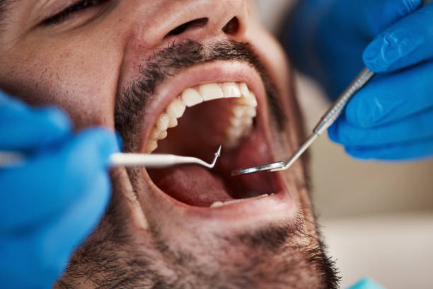 Best Emergency Dental Care for Sports Injuries in Guthrie, OK