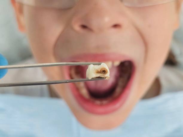 Best Urgent Dental Care for Toothaches in Guthrie, OK